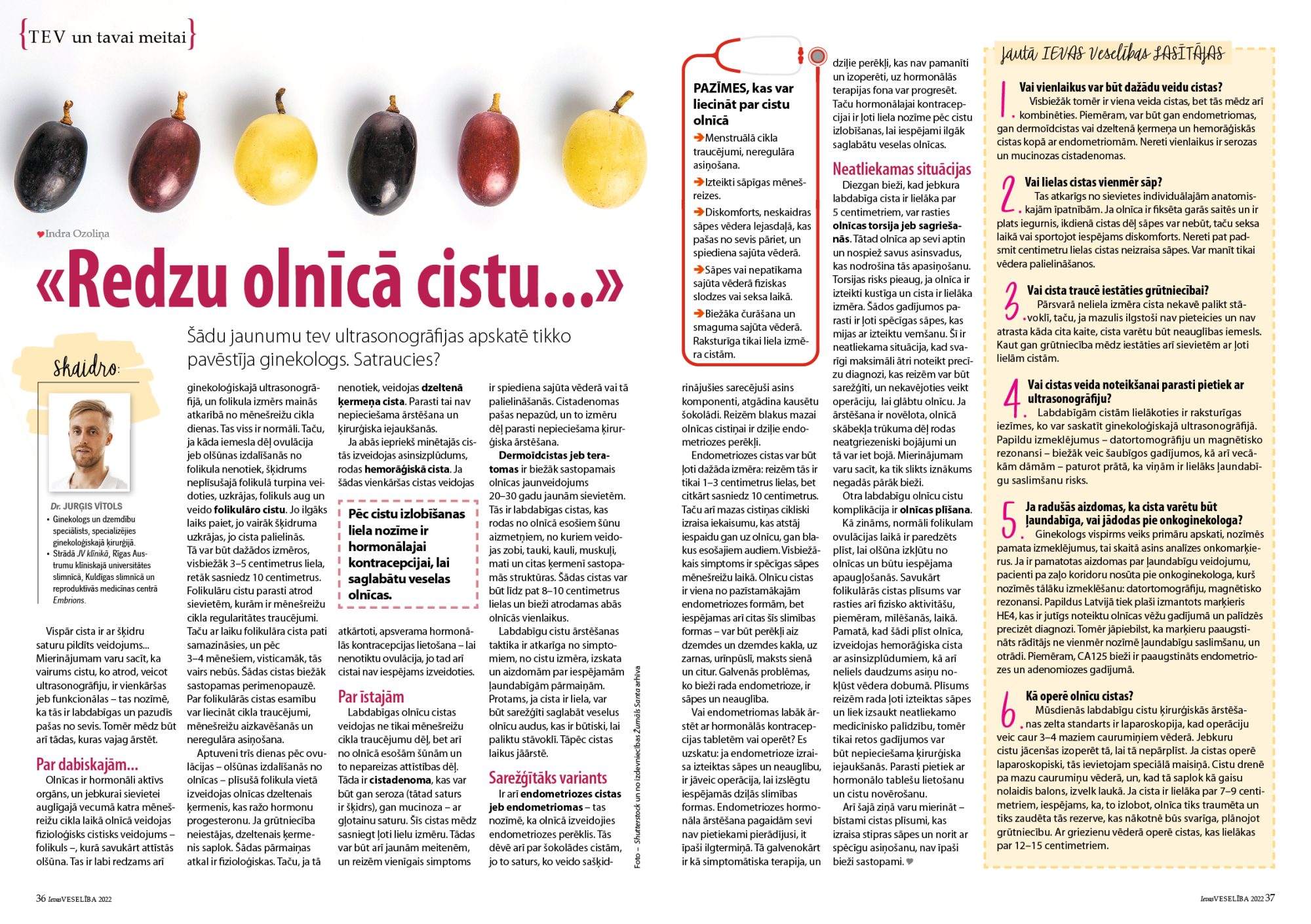 Olnīcas cista